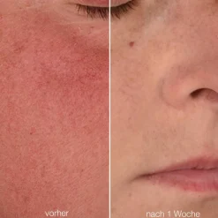 Dermalogica