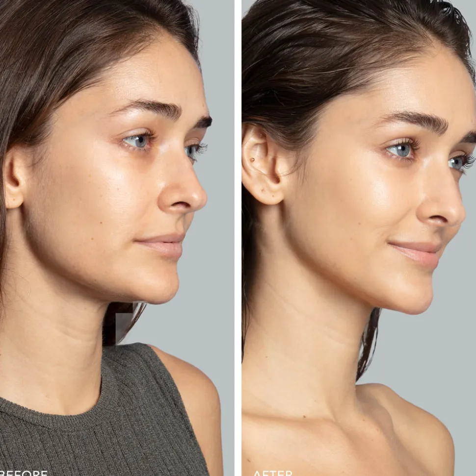 Foreo